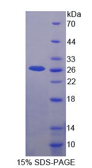 尿溶蛋白3A(UPK3A)重组蛋白