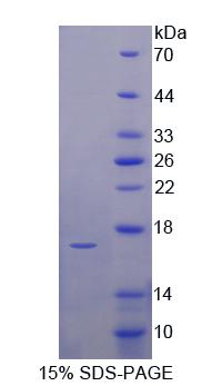 尿溶蛋白1A(UPK1A)重组蛋白