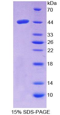 尼曼病蛋白C2(NPC2)重组蛋白