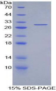 耐扭蛋白3A(TOR3A)重组蛋白