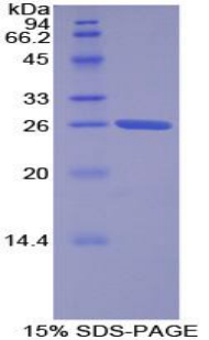 耐扭蛋白2A(TOR2A)重组蛋白