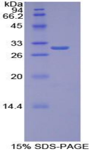 耐扭蛋白1B(TOR1B)重组蛋白