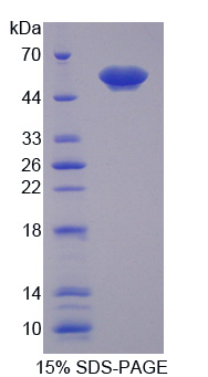 膜联蛋白A11(ANXA11)重组蛋白