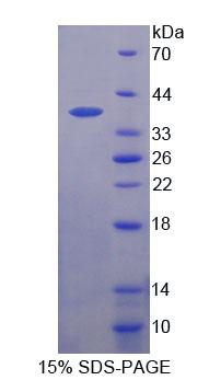 锚定蛋白重复域蛋白1(ANKRD1)重组蛋白