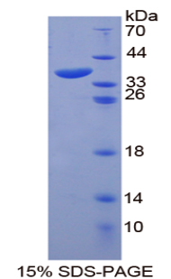 锚定蛋白1(ANK1)重组蛋白