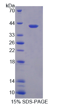 慢型肌球蛋白结合蛋白C(MYBPC1)重组蛋白