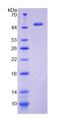 脉周蛋白1(PPHLN1)重组蛋白
