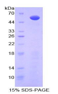 磷脂酰肌醇蛋白聚糖3(GPC3)重组蛋白