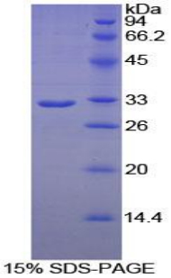 磷脂酶A2受体1(PLA2R1)重组蛋白