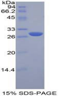 淋巴细胞激活基因3(LAG3)重组蛋白