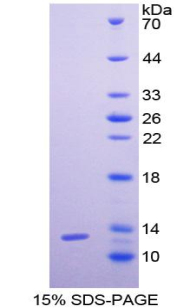 粒细胞趋化蛋白2(GCP2)重组蛋白