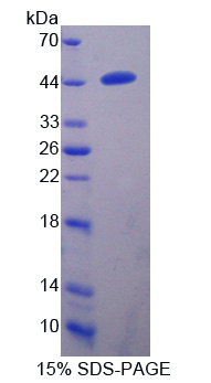 跨膜丝氨酸蛋白酶4(TMPRSS4)重组蛋白