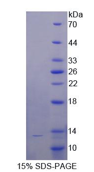 抗增生抗体靶分子1(TAPA1)重组蛋白