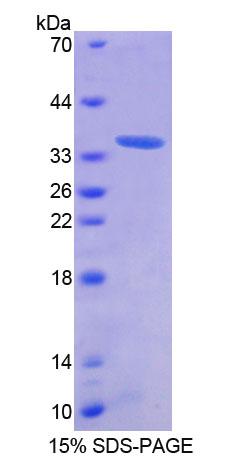 抗酶抑制因子1(AZIN1)重组蛋白