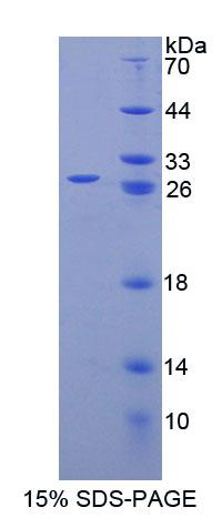 精子蛋白17(Sp17)重组蛋白