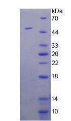 精氨基琥珀酸合成酶1(ASS1)重组蛋白