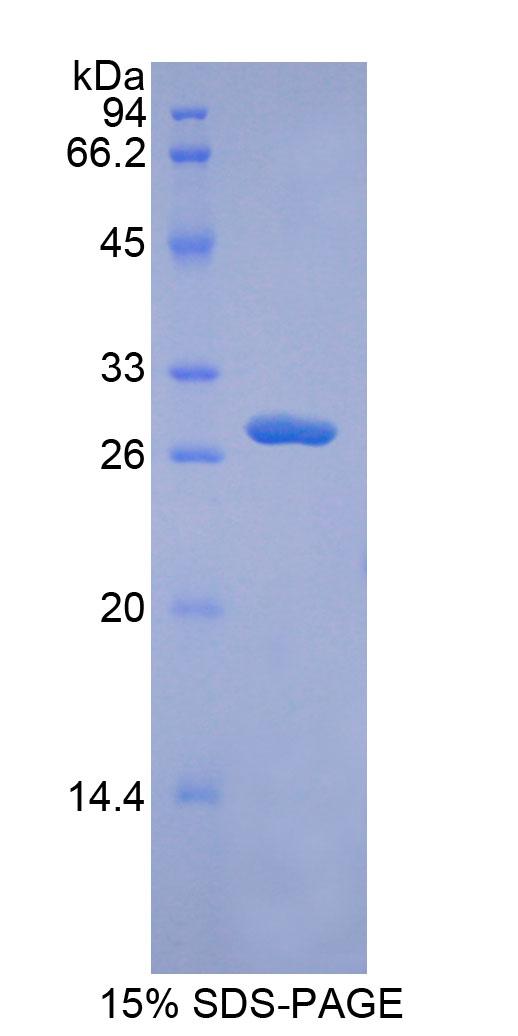 解整合素金属蛋白酶9(ADAM9)重组蛋白