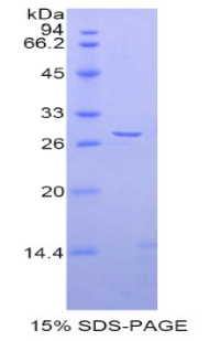 解整合素金属蛋白酶5(ADAM5)重组蛋白