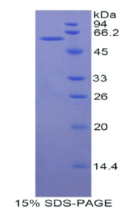 结肠癌转移关联基因1(MACC1)重组蛋白