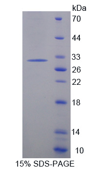 接触蛋白6(CNTN6)重组蛋白