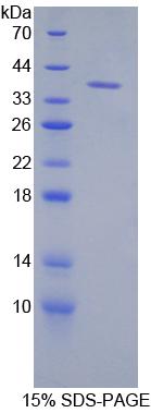 角蛋白7(KRT7)重组蛋白