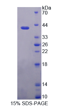 角蛋白6C(KRT6C)重组蛋白