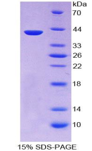 角蛋白3(KRT3)重组蛋白
