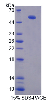 腱蛋白样蛋白1(CHRDL1)重组蛋白