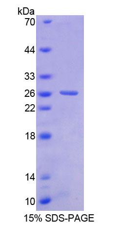 碱核蛋白1(BNC1)重组蛋白