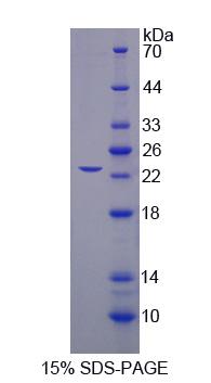 剪接因子3B亚基3(SF3B3)重组蛋白