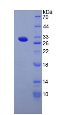 甲状腺球蛋白(TG)重组蛋白