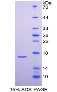 甲状旁腺素受体2(PTHR2)重组蛋白