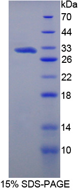 甲基转移酶样蛋白21C(METTL21C)重组蛋白