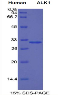 激活素受体样激酶1(ALK1)重组蛋白