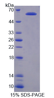 激活STAT蛋白抑制因子3(PIAS3)重组蛋白