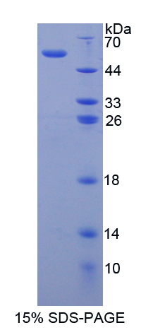 基质金属蛋白酶15(MMP15)重组蛋白