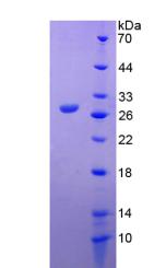 基质金属蛋白酶14(MMP14)重组蛋白