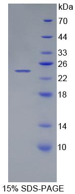 肌肽酶1(CNDP1)重组蛋白
