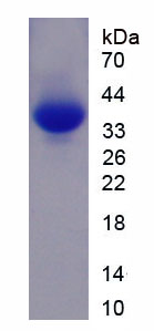 肌球蛋白重链6(MYH6)重组蛋白