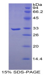 肌球蛋白重链16(MYH16)重组蛋白