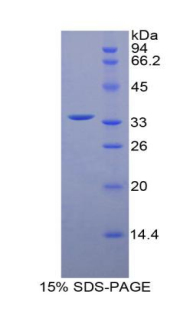 肌球蛋白轻链激酶4(MYLK4)重组蛋白