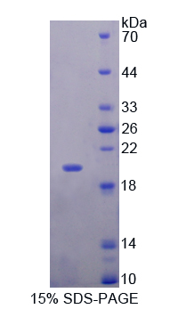 肌球蛋白轻链6(MYL6)重组蛋白