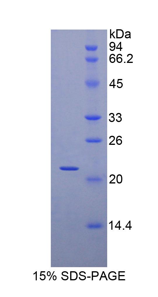 肌球蛋白轻链3(MYL3)重组蛋白