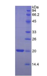 肌球蛋白轻链2(MYL2)重组蛋白