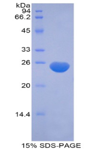 肌球蛋白轻链12B(MYL12B)重组蛋白