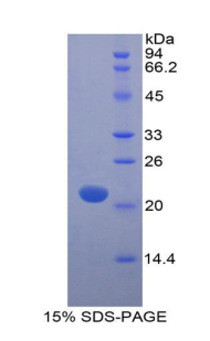 肌球蛋白轻链12A(MYL12A)重组蛋白