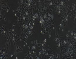 人皮肤基底细胞癌细胞；A-431