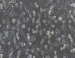 人乳腺导管癌细胞；BT-549