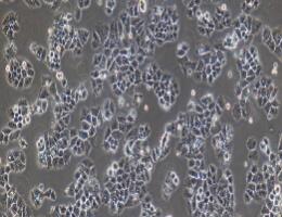 人卵巢癌细胞；Caov-3