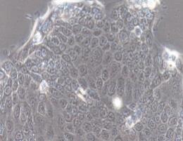 人胰腺癌细胞；Capan-2